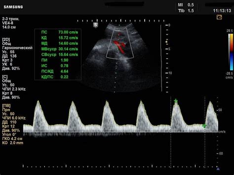 Центр пренатальной диагностики и гинекологии Эксперт
