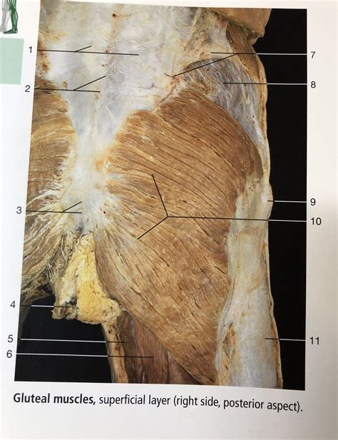 Gluteal Muscles Cadaver Posterior Superficial Diagram Quizlet The