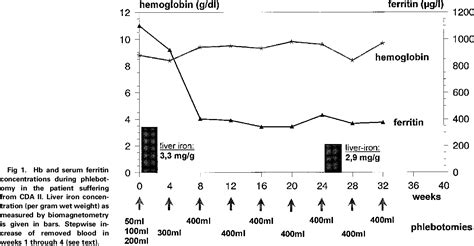 Figure From Both Paroxysmal Nocturnal Hemoglobinuria Pnh Type Ii