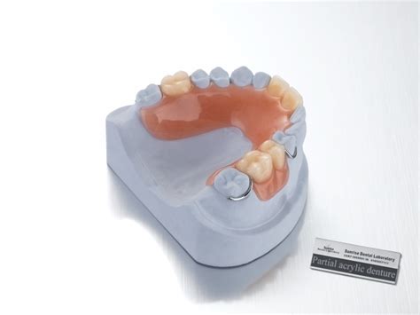 Acrylic Partial Denture,ACRYLIC DENTURE