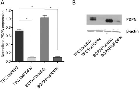 Expression Of Podoplanin PDPN At Transcript A RT QPCR And Protein