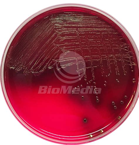 Селективные и дифференциальные среды для Escherichia coli