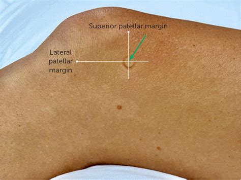 Injections Of The Hip And Knee Aafp