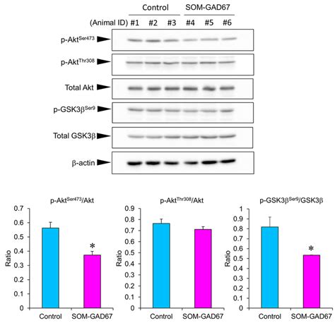 Protein Levels Of Akt And Glycogen Synthase Kinase 3 β Gsk3β In The Download Scientific