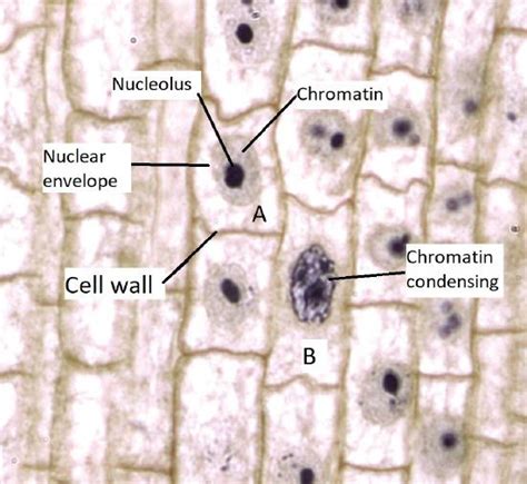 Onion Root Tip Mitosis Labeled Diagram