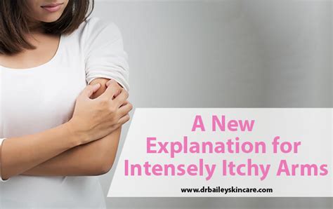 A New Explanation And Tips For Intensely Itchy Arms And Skin Brachioradial Pruritus