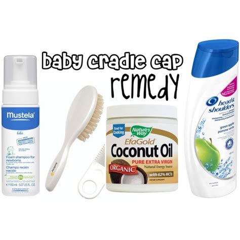 Baby Cradle Cap Remedy Beauty Parler