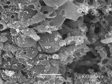 Possible fungal haustoria in algal layer of the lichen Umbilicaria ...