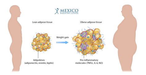 Does Bariatric Surgery Improve Adipose Tissue Function? - Fat Tissue