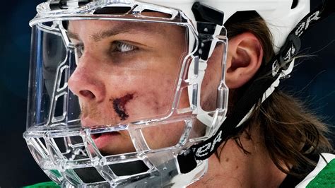 Stars Kraken Miro Heiskanen Returns After Taking Puck To Face Sports Illustrated