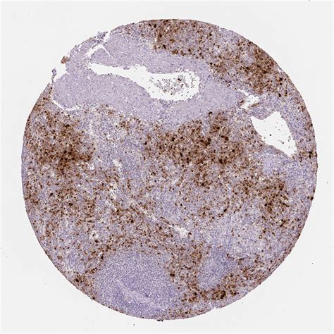 Tissue Expression Of DEFA3 Staining In Spleen The Human Protein Atlas