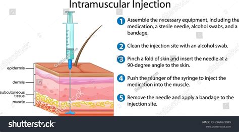 Intramuscular Injection with explanation - Royalty Free Stock Vector ...