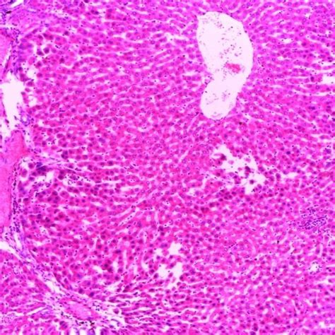 Photomicrograph Showing Histopathology Of The Liver Of A Rat After