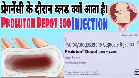 Proluton Depot Mg Injection Hydroxyprogesterone Caproate