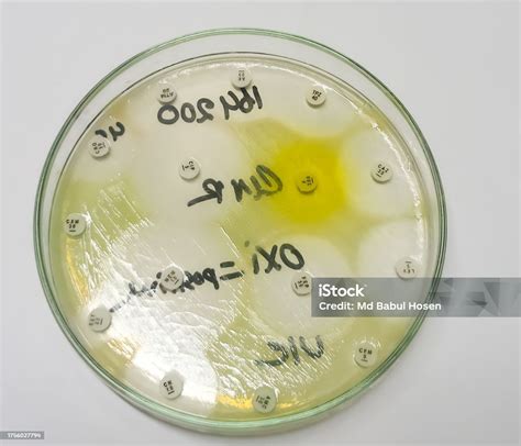 Antimicrobial Susceptibility Testing Pseudomonas Aeruginosa In Culture