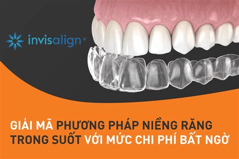 Niềng Răng Trong Suốt Invisalign Giá Bao Nhiêu