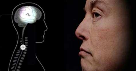 Neuralink Elon Musk Está Listo Para Implantar Chips De Computadora En