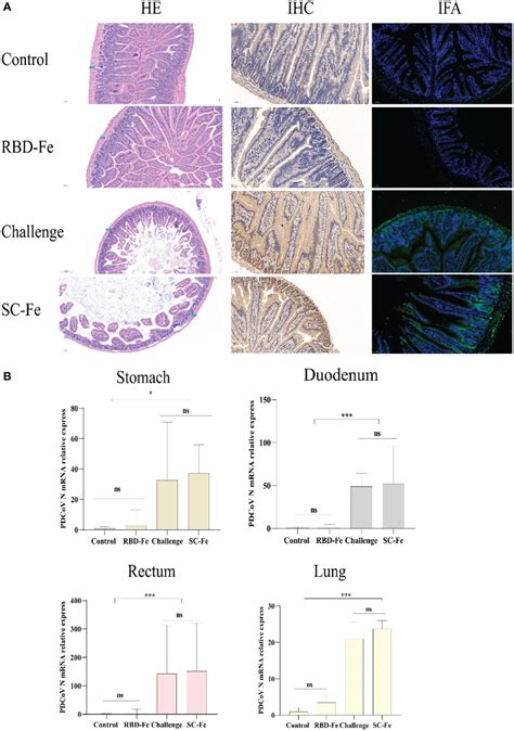 Frontiers Nanoparticle Vaccines Based On The Receptor Binding Domain