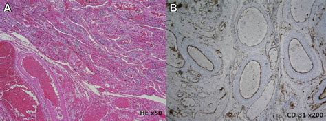 (A) The omentum histologically is composed of multiple blood vessels of... | Download Scientific ...