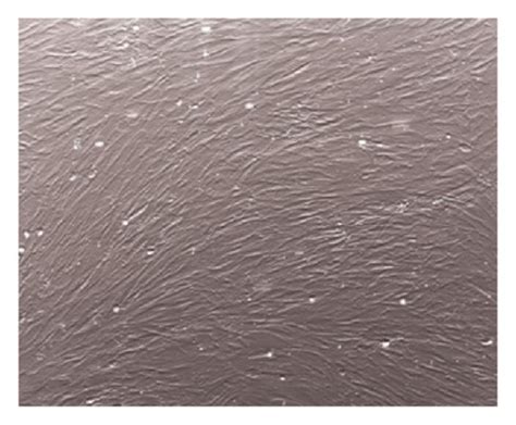 Cell morphological changes after differentiation into neural and glial ... 