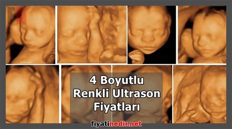 4 Boyutlu Renkli Ultrason Fiyatları 2024 Yeni