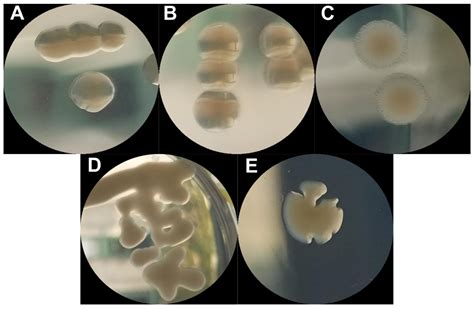 Escherichia Coli Colony Morphology