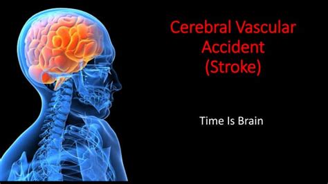 Cerebral Vascular Accident Ppt