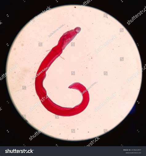 567 Imagens De Schistosomiasis Imagens Fotos Stock E Vetores Shutterstock