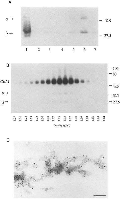 Analysis of exosomes isolated from P,.N cell culture media. (A ... 
