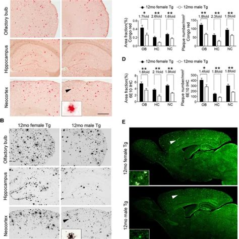 At 12 Months Of Age Female Appps1 Mice Display More Severe Tau Download Scientific Diagram