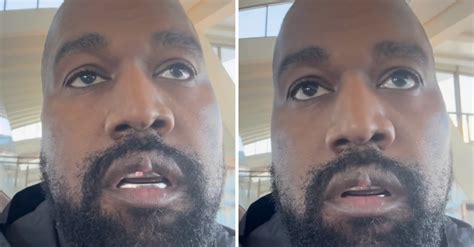 Fans Concerned About Kanye West As He Sports Odd Bulbous Lip In New Video