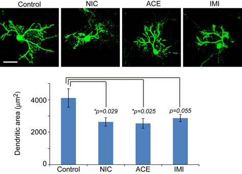 Dendritic Arborization Of Purkinje Cells In Cerebellar Cultures Exposed