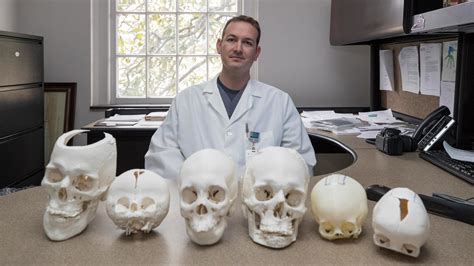 Surgeon Uses 3 D Printed Skulls To Prepare For Delicate Procedures