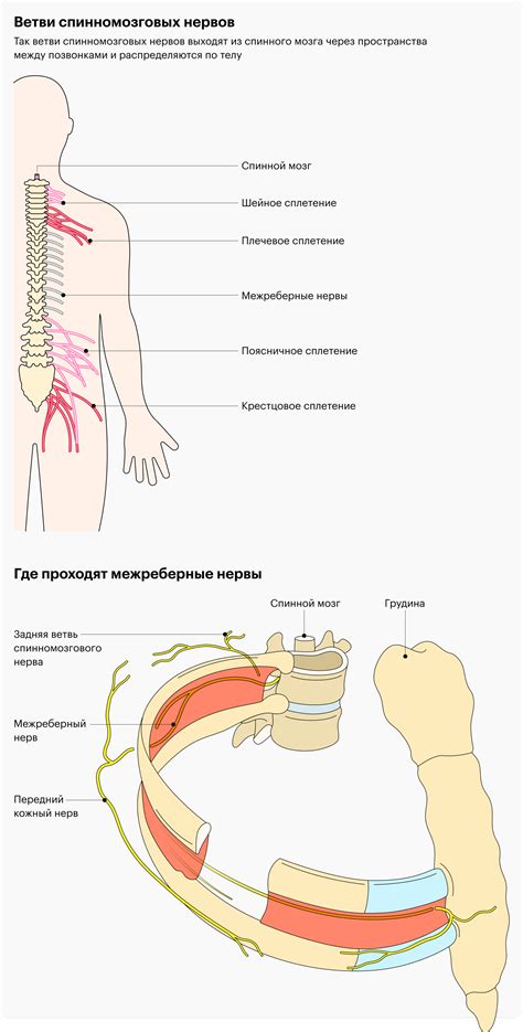 Межреберная невралгия: почему появляется и как лечить