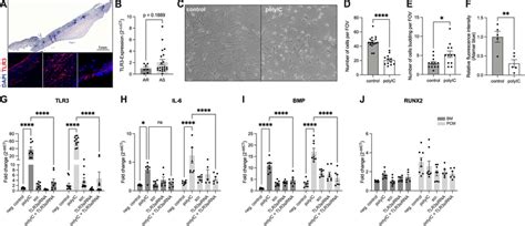 Tlr3 Is Expressed In Human Aortic Valves And Tlr3 Stimulation Activates