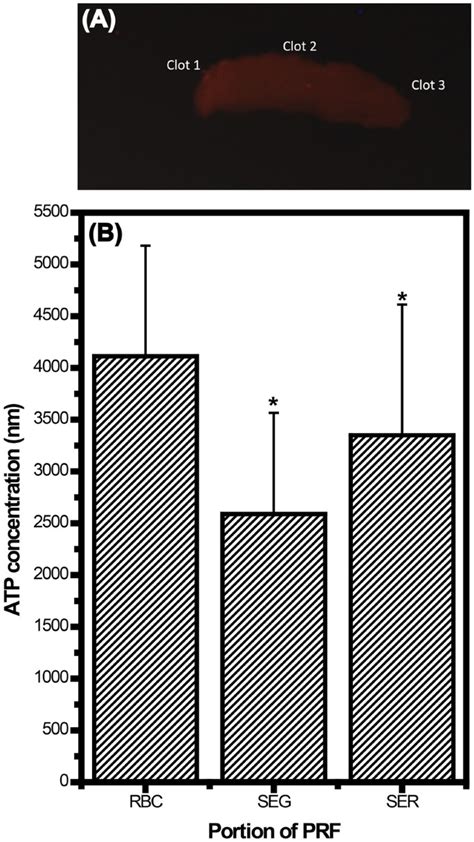 Relationships Of Age And Sex With Cytokine Content And Distribution In