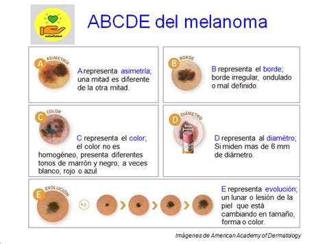 Cáncer De Piel Y Melanoma