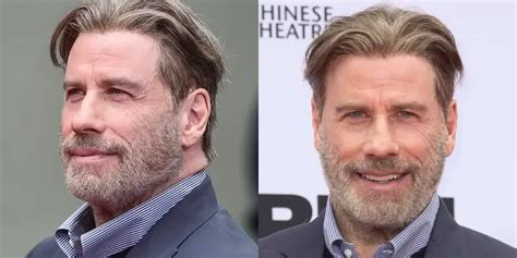 Is John Travolta Bald, And Why? - Hair System