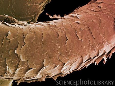 Red Hair Under Microscope