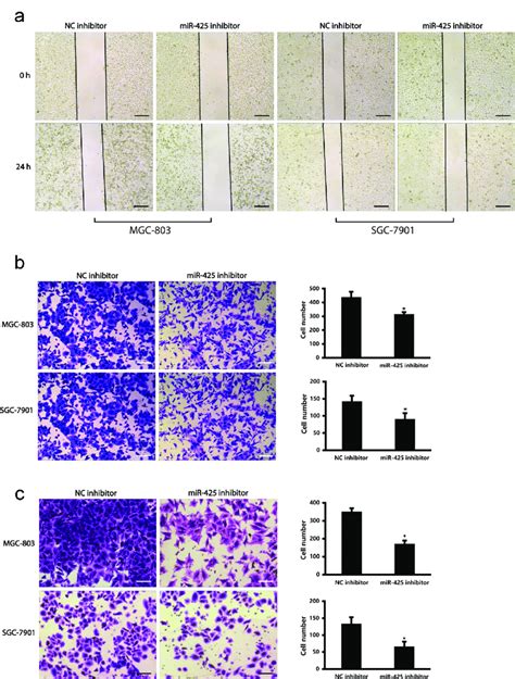 MiR 425 Promotes Cell Migration And Invasion In MGC 803 And SGC 7901