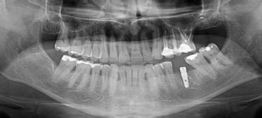 Diagnostyka Cbct Rtg Pantomogram Cefalometria Rtg Pa Dentysta