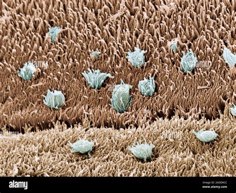 Coloured Scanning Electronmicrograph Sem Of The Surface Of A Tapeworm Eubothrium Crassum E