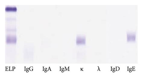 a Serum immunofixation demonstrating a monoclonal IgE kappa κ