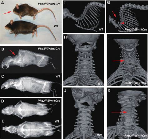 Vertebral Column Of Pkd2 Fl Fl Wnt1cre Mice Shortened Snout Arrow Download Scientific