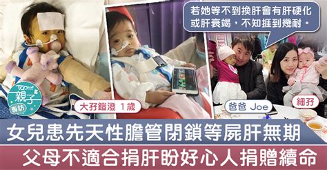 【捐肝救人】1歲女童患先天性膽管閉鎖 港爸盼好心人捐肝︰她不知捱到幾耐