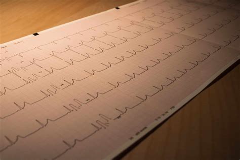 Ecg Vs Ekg What S The Difference