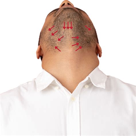 Why Does My Facial Hair Grow So Fast (Beards, Mustaches, and Sideburns)