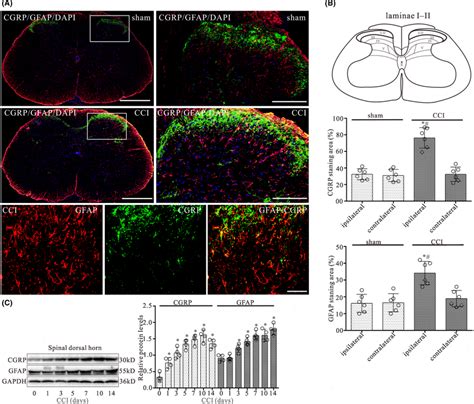 Cci Evokes Increases In The Expression Of Cgrp And Gfap In The