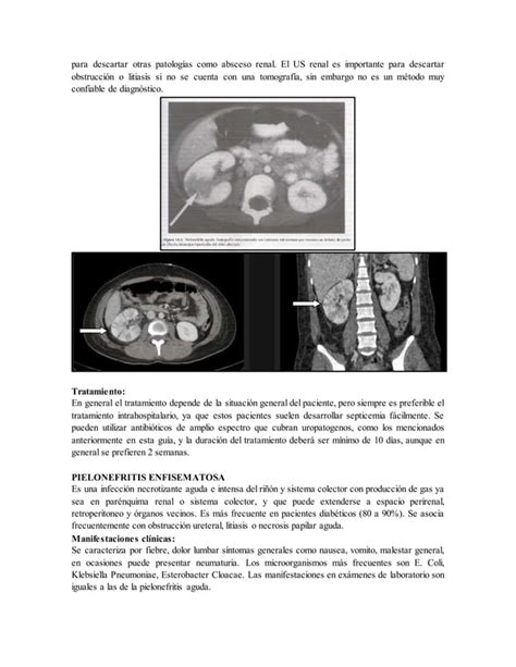 Infección urinaria guía de estudio PDF