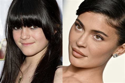 Kylie Jenner Shuts Down Rumors That She Got A Lot Of Plastic Surgery